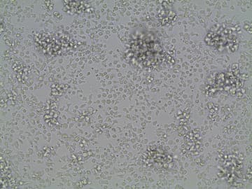 picture of T cells being multiplied in the lab