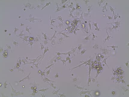 picture of T cells (in red) entering a pancreatic islet