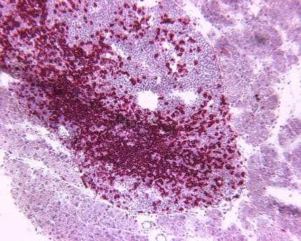 picture of T cells (in red) entering a pancreatic islet